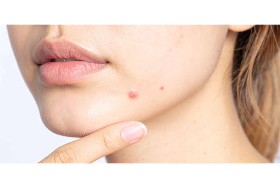 Point blanc visage : Comment anticiper et régler ce problème ?