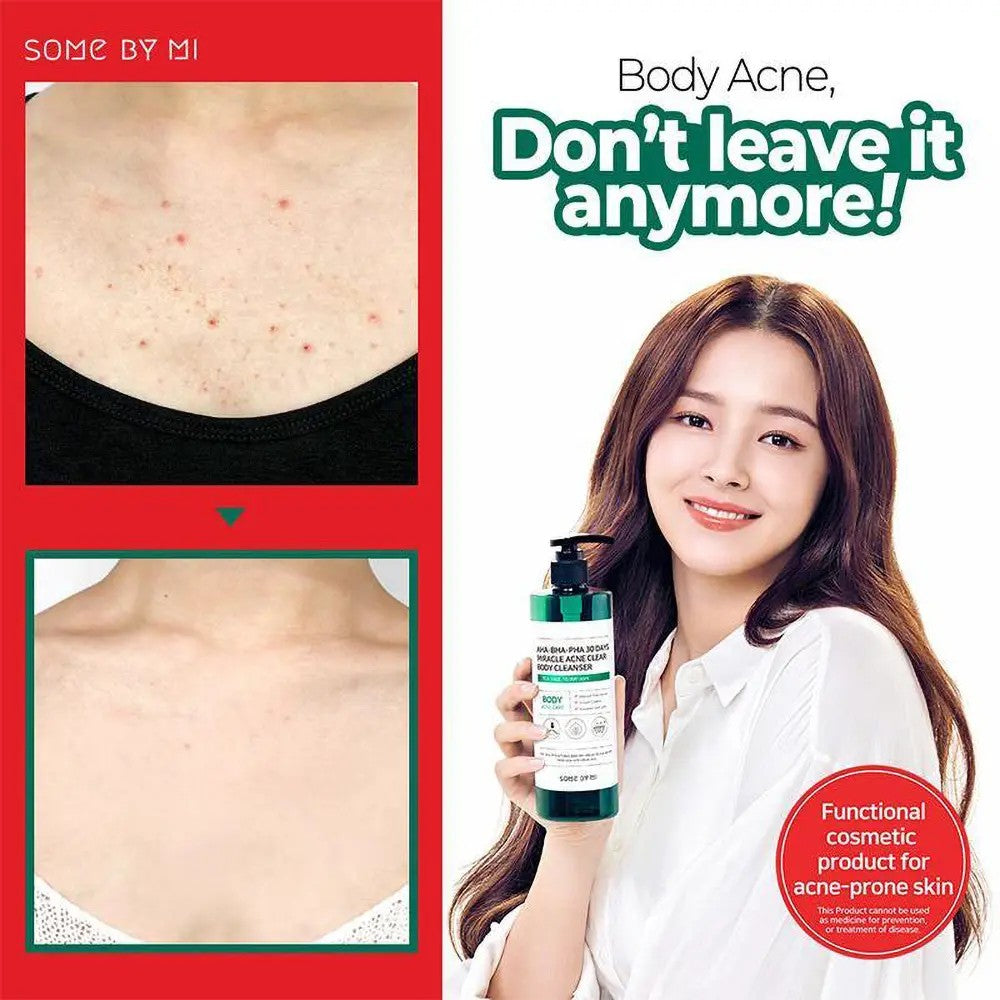Nettoyant corps AHA-BHA-PHA 30 Days Miracle Acne Clear Body Cleanser contre l’acné pour une peau douce, purifiée et lisse