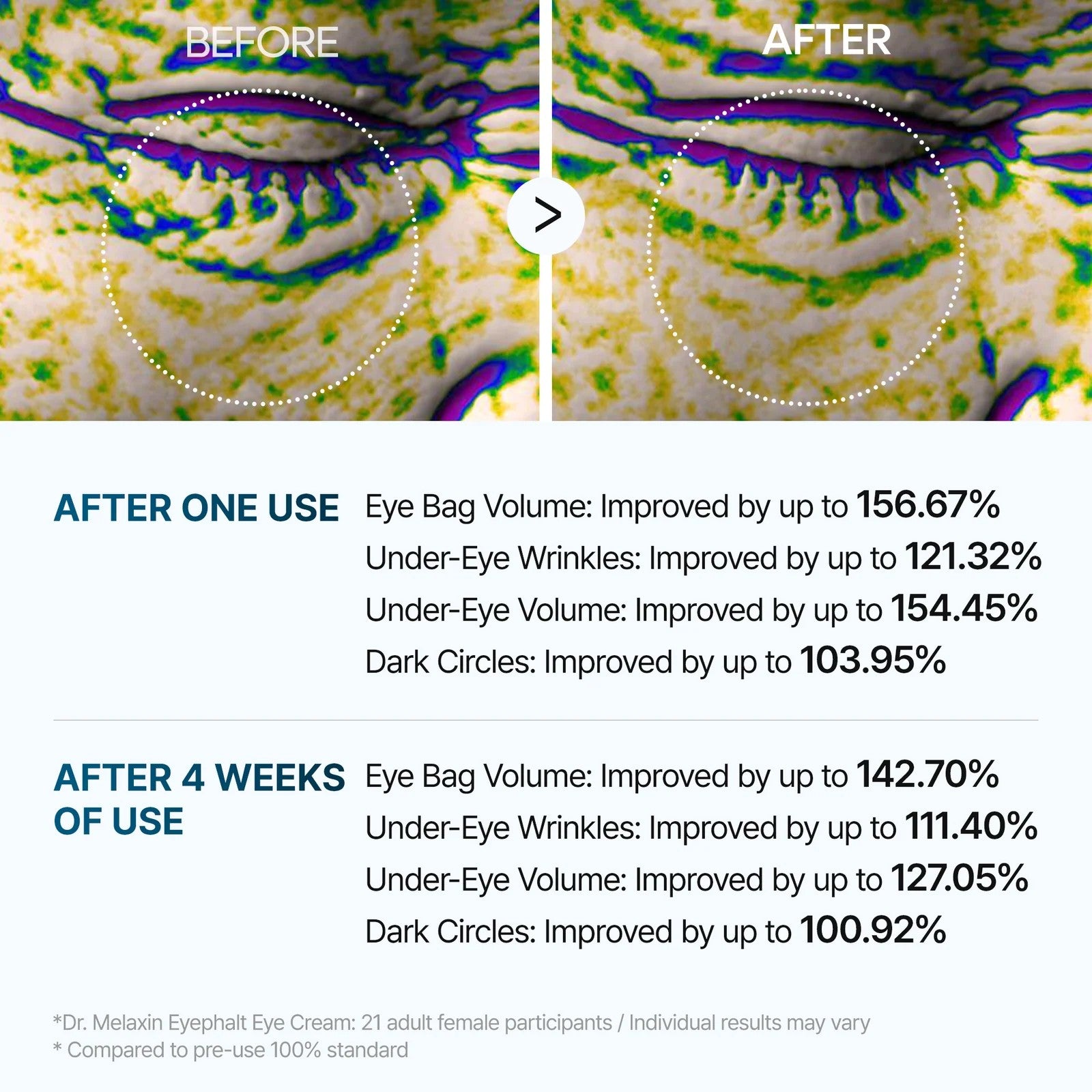 Dr Melaxin Eyephalt Eyebag Cream crème contour des yeux coréenne ciblant poches et cernes avec effet lissant et raffermissant