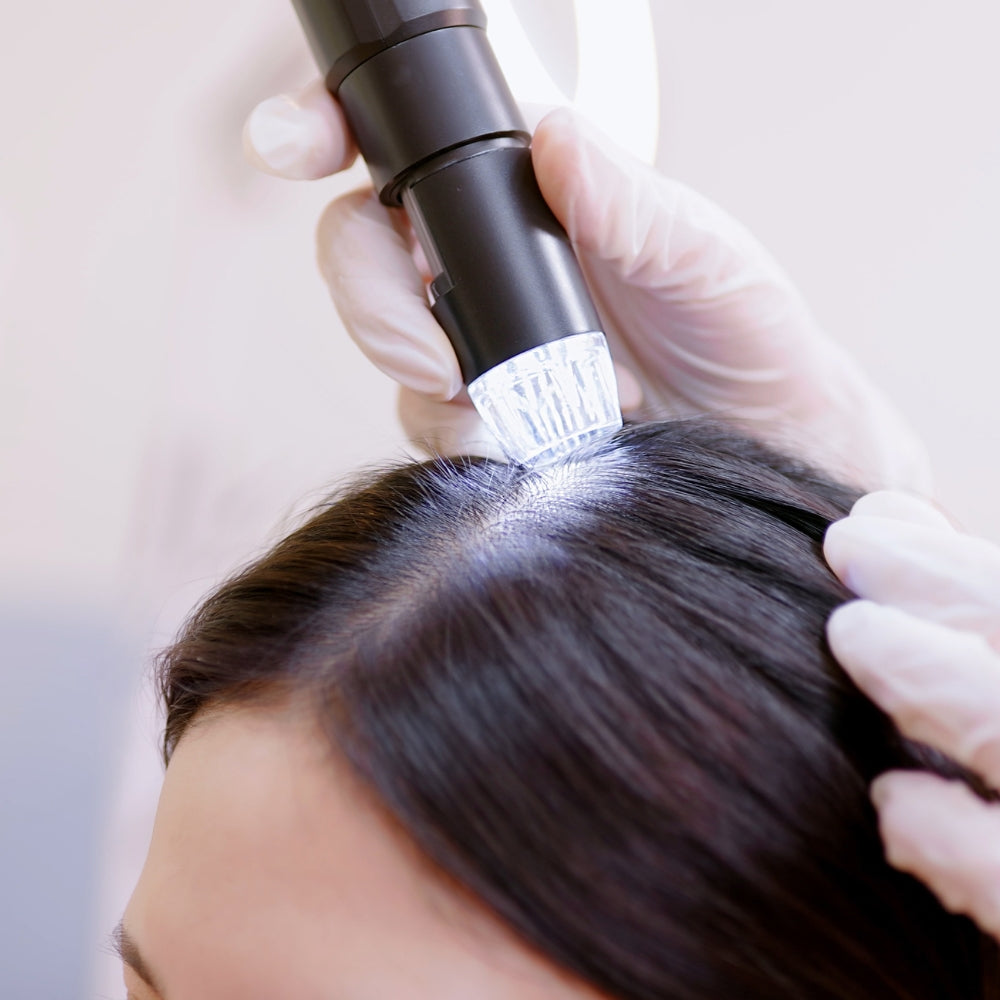 Diagnostic du cuir chevelu