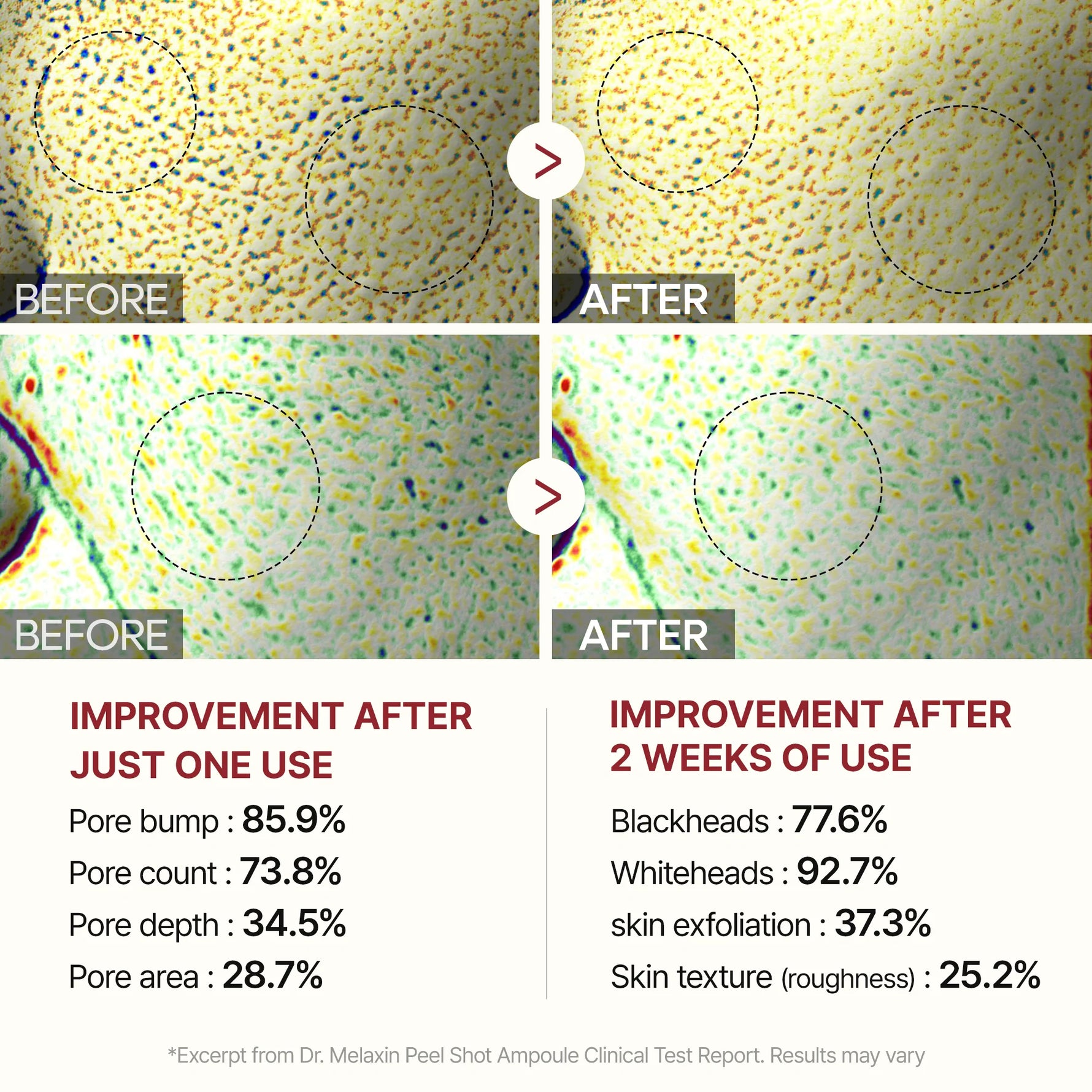 Dr.Melaxin
Peel Shot Exfoliant Rice Ampoule