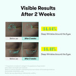 VT PDRN Reedle Shot Eye Lifter, bénéfices, soin coréen K Beauty Cosmetics