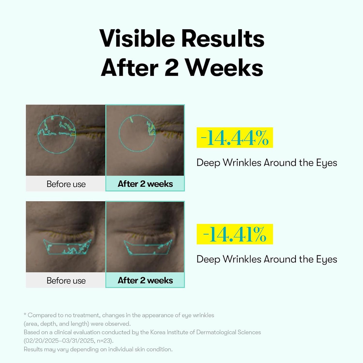 VT PDRN Reedle Shot Eye Lifter, bénéfices, soin coréen K Beauty Cosmetics